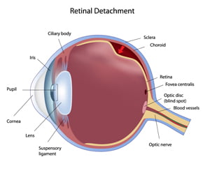 Retinal Diseases Image 2 | Ophthalmic Consultants
