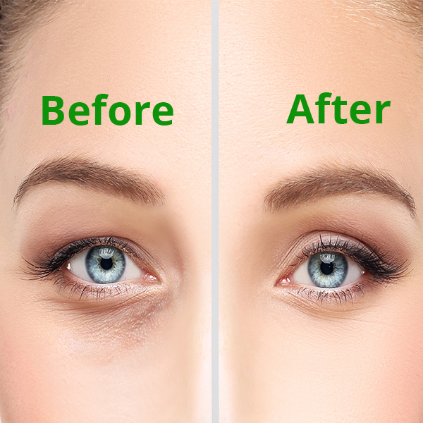 Medical Cosmetic Procedures Ophthalmic Consultants NY