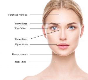 COSMETIC Botox® | Ophthalmic Consultants, NY