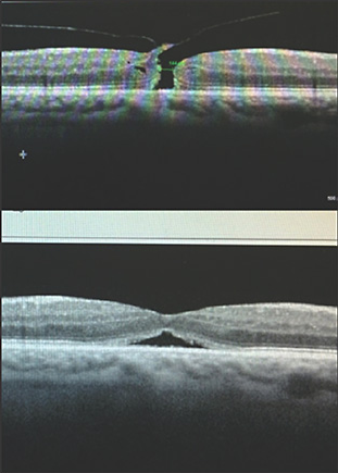 Research | Ophthalmic Consultants, NY